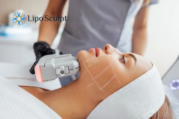 HIFU vs Botulinum Toxin: Understanding the Differences 1 HIFU vs Botox Wantage What is the best option for you?