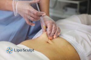 Does Skin Sag After Fat Dissolving Injections? 2 Do you want to get Aqualyx fat dissolving injections Wantage but worried about loose skin afterwards?